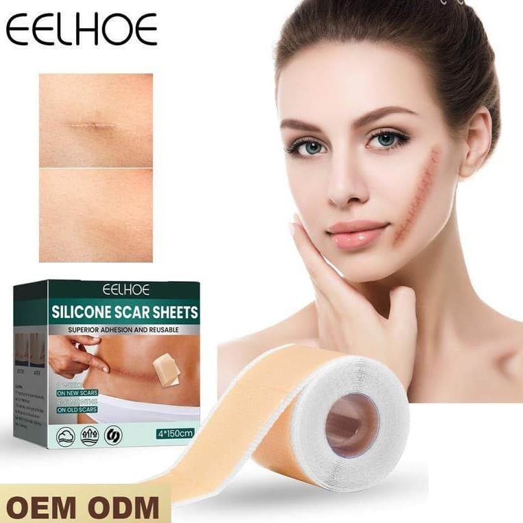 EELHOE Silicone cicatriz remendo gravidez cesariana cicatriz cirúrgica tom de pele invisível beleza remendo cicatriz rep