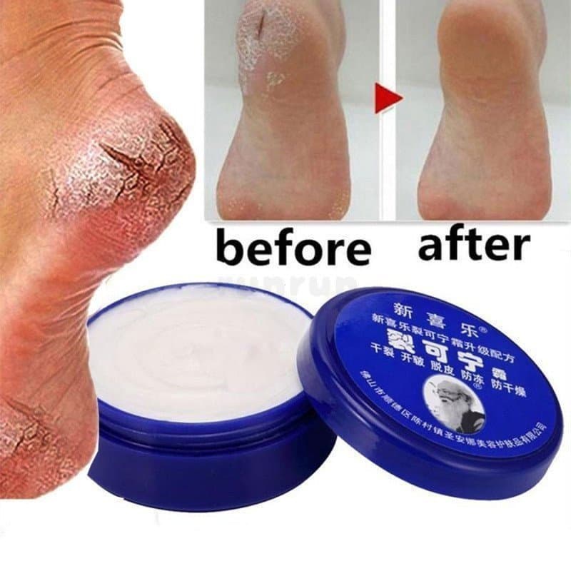 Óleo Tradicional Chinês 33g Anti-Secagem Creme Para Os Pés Rachaduras De Reparo Remoção De Pele Morta As Mãos Máscara