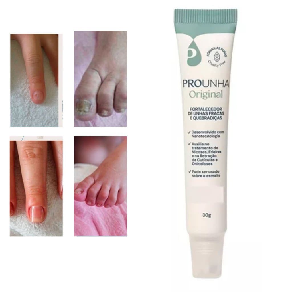 Fortalecedor De Unhas Tea Tree Pro Unha 30g Melaleuca - Pro unha  micose