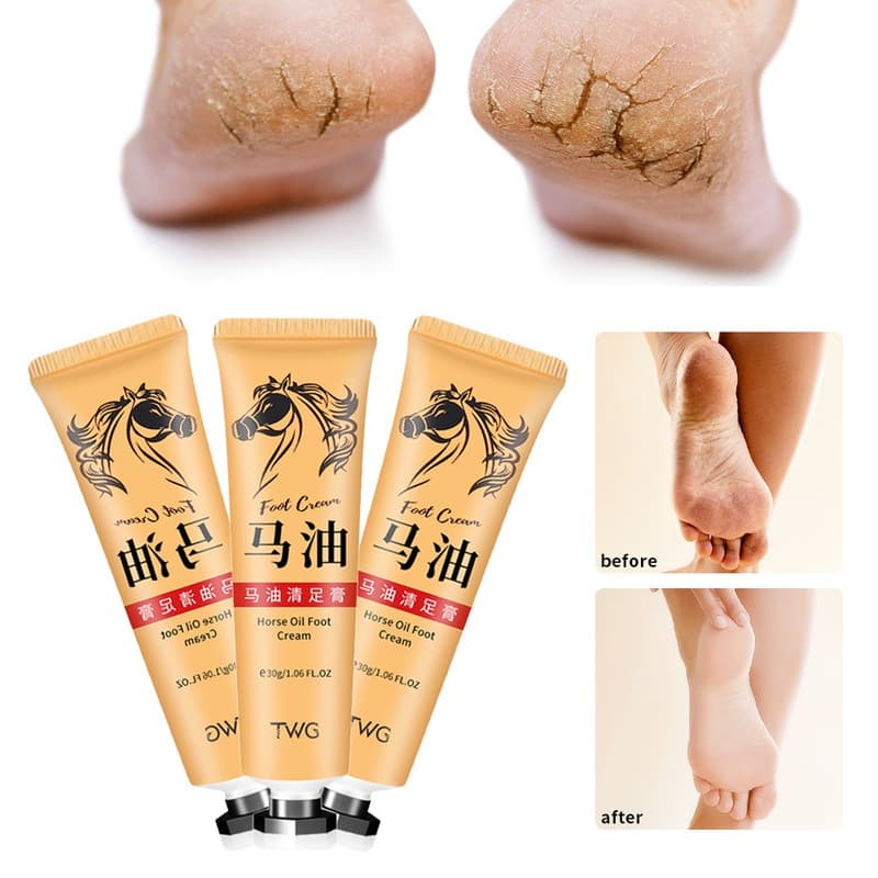 Creme para os pés com óleo de cavalo 30g, hidratação de longa duração, repara calcanhares rachados, esfolia.