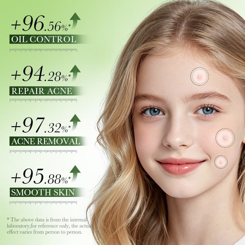 Acne Pimple Patches Tratamento Hidrocolóide Transparente Para Manchas De 36 Contagens Com Ácido Salicílico