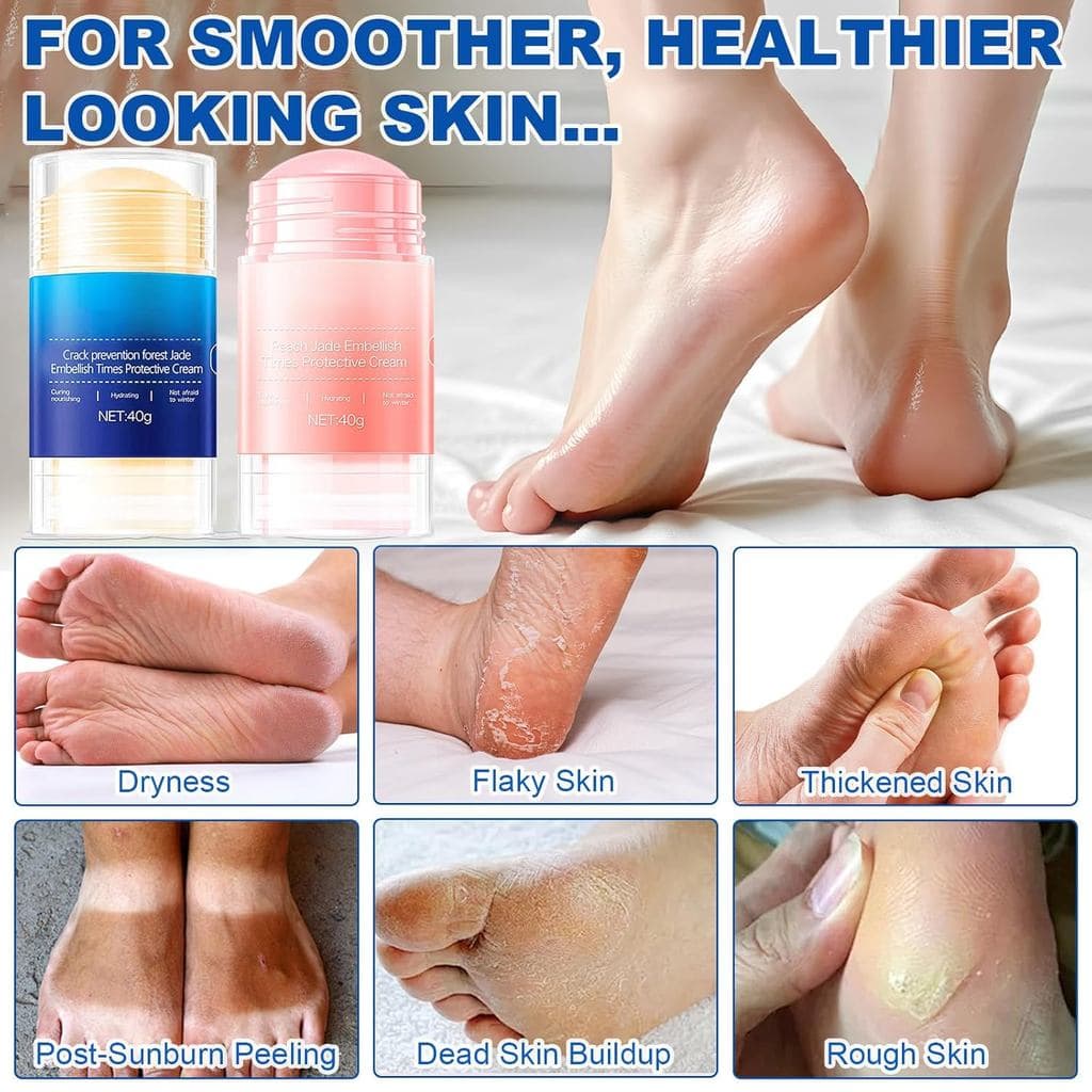 Bastão para Prevenção de Rachaduras nos Pés, Creme de Ureia 60%, Bastão de Creme Anti-Rachaduras para os Pés, Bastão de