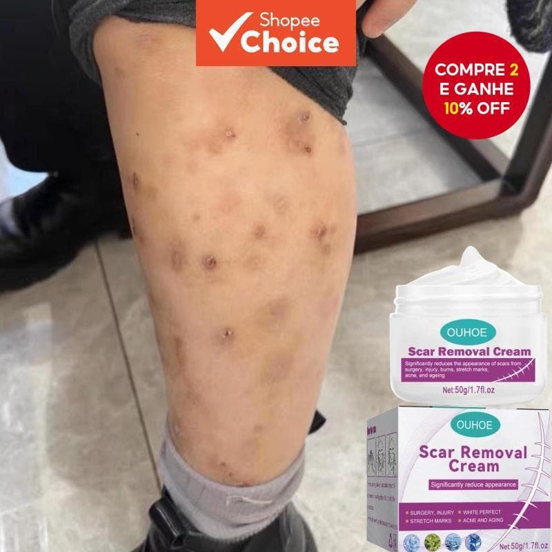 Novo Creme Reparador e Suavizante, adequado para feridas, clareamento da pele e pele pós-cirúrgica, 50 gramas.