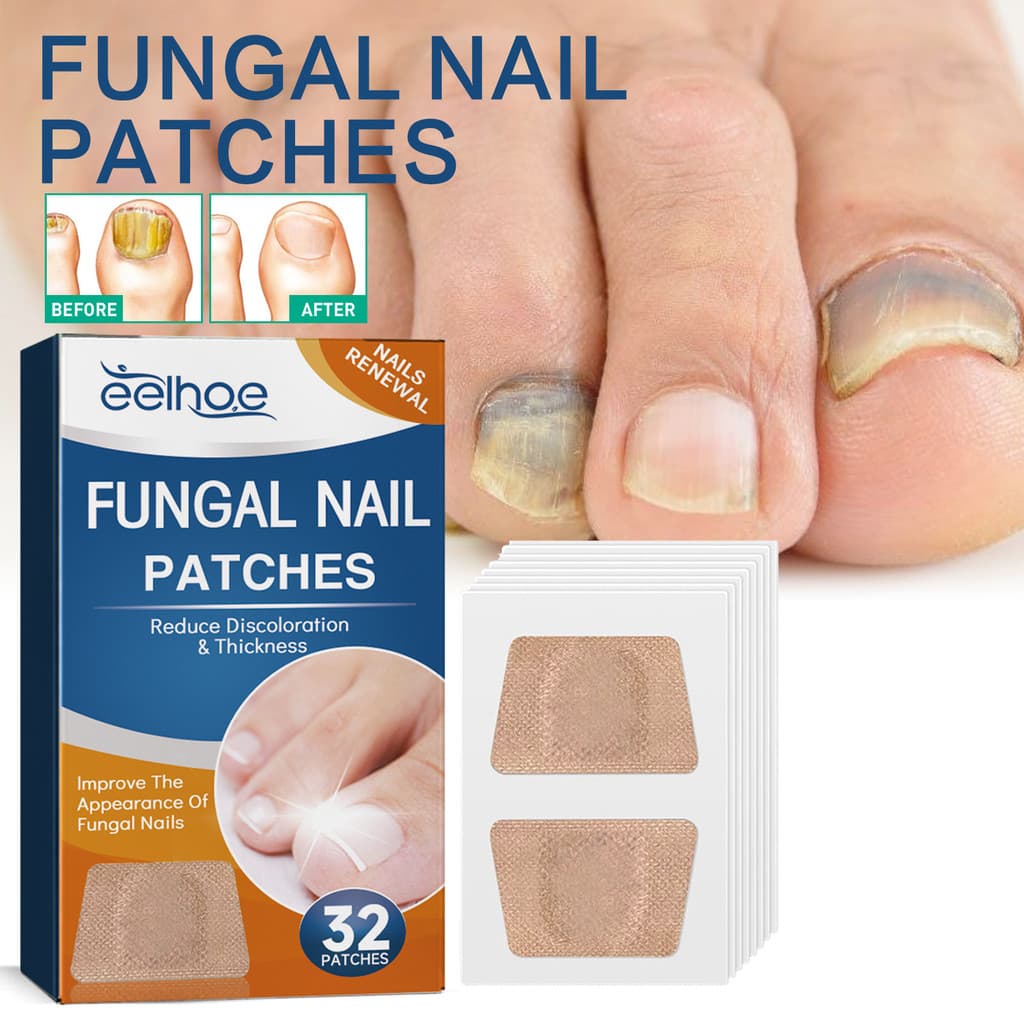 32 Adesivos Antifúngicos Para Unhas Tratamento De E Reparo