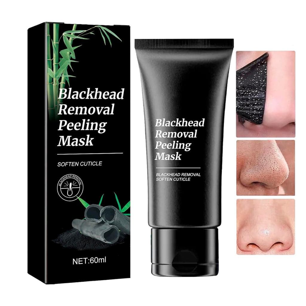Máscara Facial Removível - Máscara Removedora de Cravos com Carvão Ativado e Aloe |   Removedor de Cravos para Rosto e N
