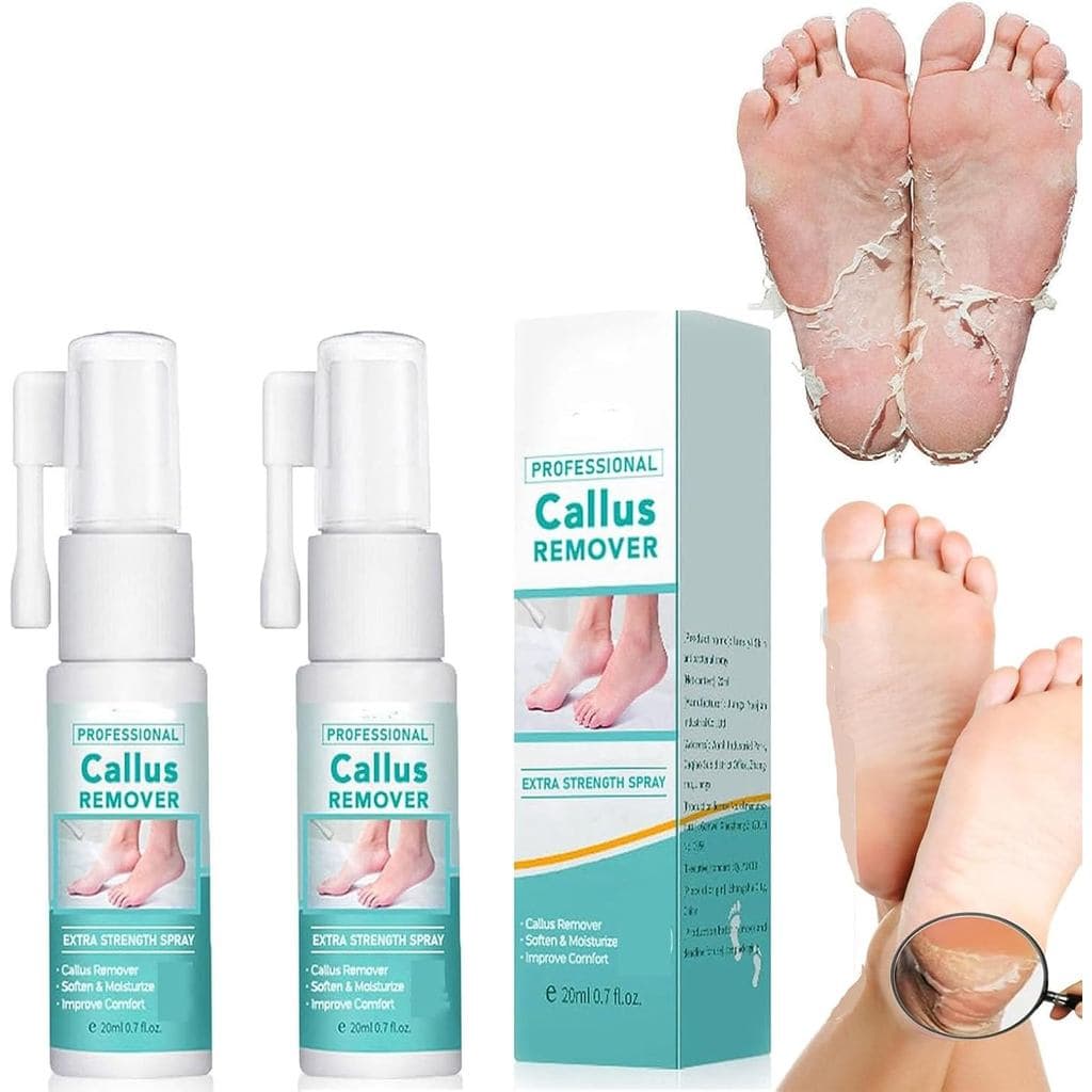 Removedor de Calos Profissional em Spray de Força Extra, Spray para Remoção de Calos nos Pés, Spray Removedor de Calos n