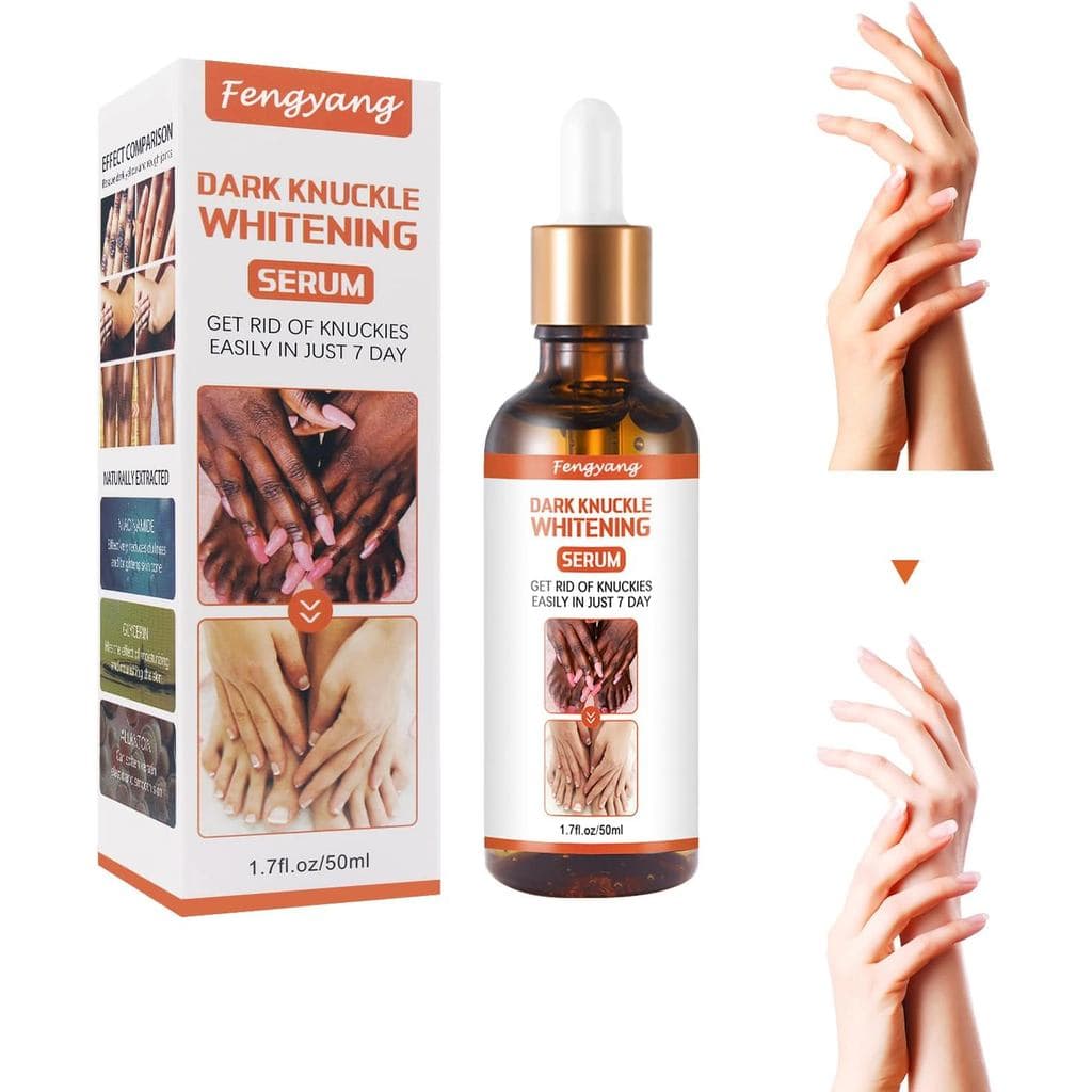 Fengyang ®     Essência Clareadora para Articulações, Essência Clareadora Poderosa, adequada para o clareamento das arti
