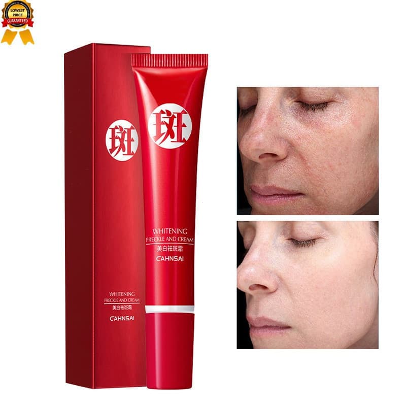 Creme Branqueador Anti-Rugas Original Forte Poderoso Remoção De Idade Manchas Escuras Pigmentação Brilhante Cuidados Com