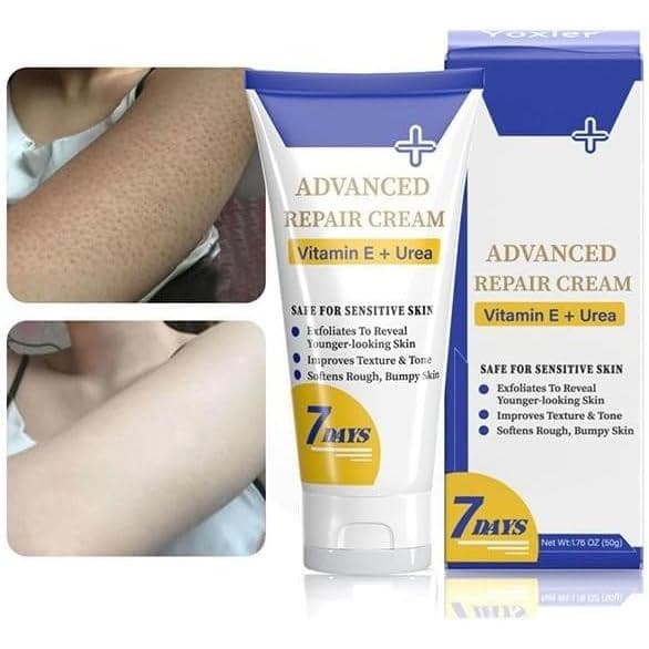 Tratamento para Queratose Pilar, Creme Hidratante para Queratose Pilar, Esfoliante Corporal para Tratamento de Pernas de