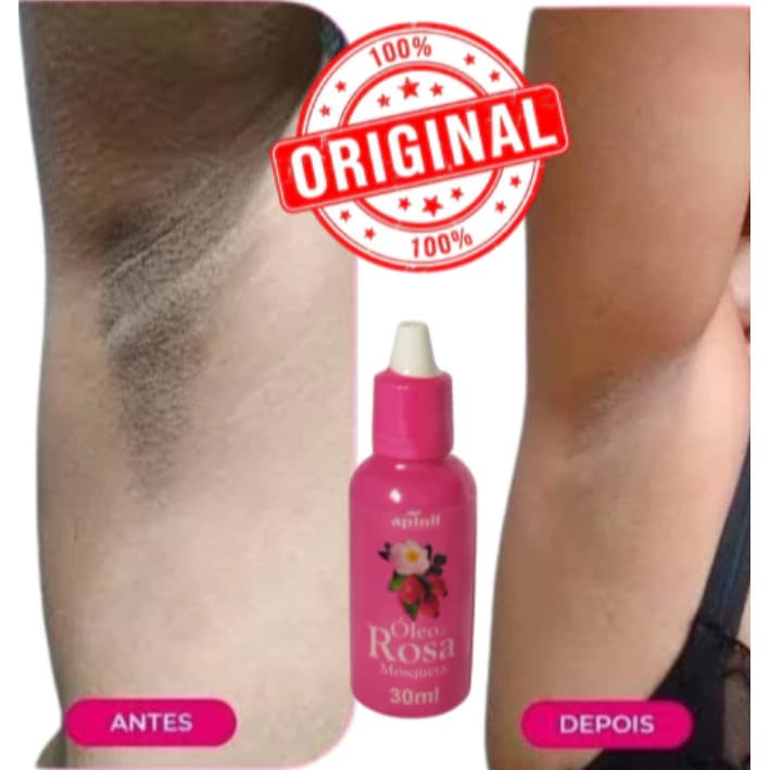 ÓLEO DE ROSA MOSQUETA 30ml - APINIL