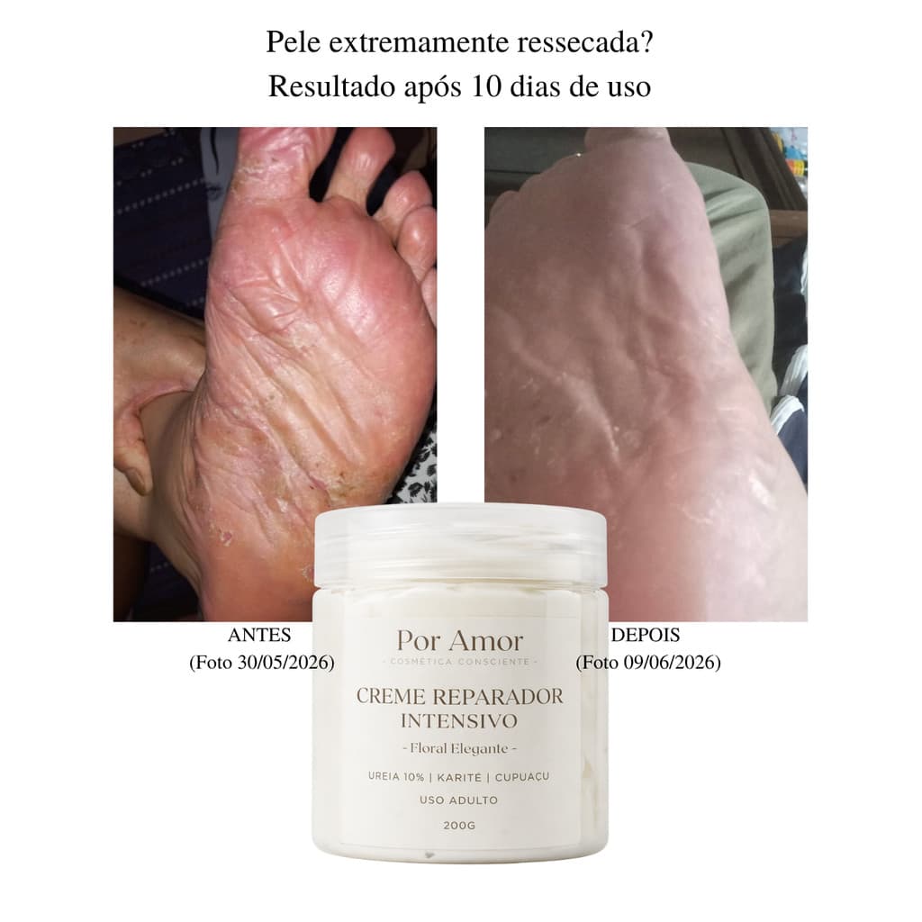Creme Mãos Pés Cotovelos Rachados Ureia 10% Pele Seca Hidratante Intensivo Karité Cupuaçu Reparador