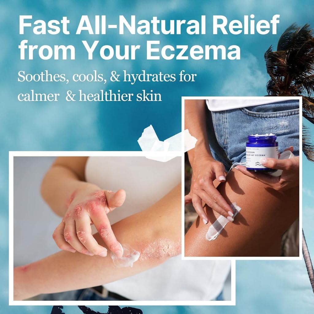 Creme Natural para Alívio de Eczema Ocean Healing - Creme Nutritivo para Psoríase com Algas Marinhas e Aveia Coloidal -