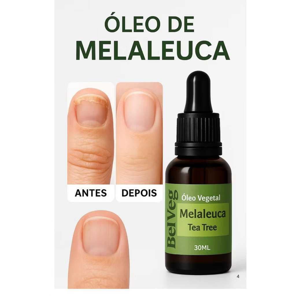 Óleo Vegetal Melaleuca Tea Tree 100% Puro 30ml Para Unha Pele Cabelo antifúngico micose