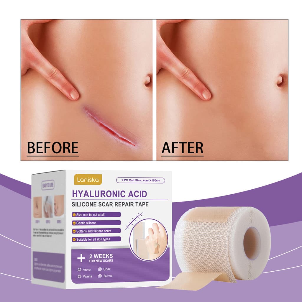 【HOT】 Fita de Silicone Nano Microneedle de Ácido Hialurônico, Patch de Cicatriz Reutilizável de Grau Médico para