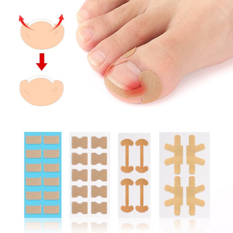 Adesivo elástico autoadesivo para correção de unhas, adesivo para reparação de unhas encravadas, fivela de correção para