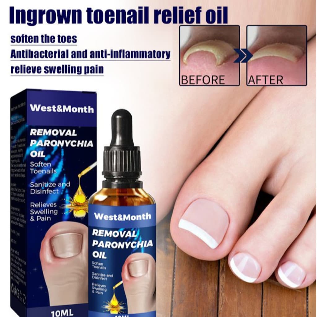 [Hidratação Profunda] Óleo de cuidado para unhas encravadas, ideal para cuidados diários. Unhas/Óleo/Pés