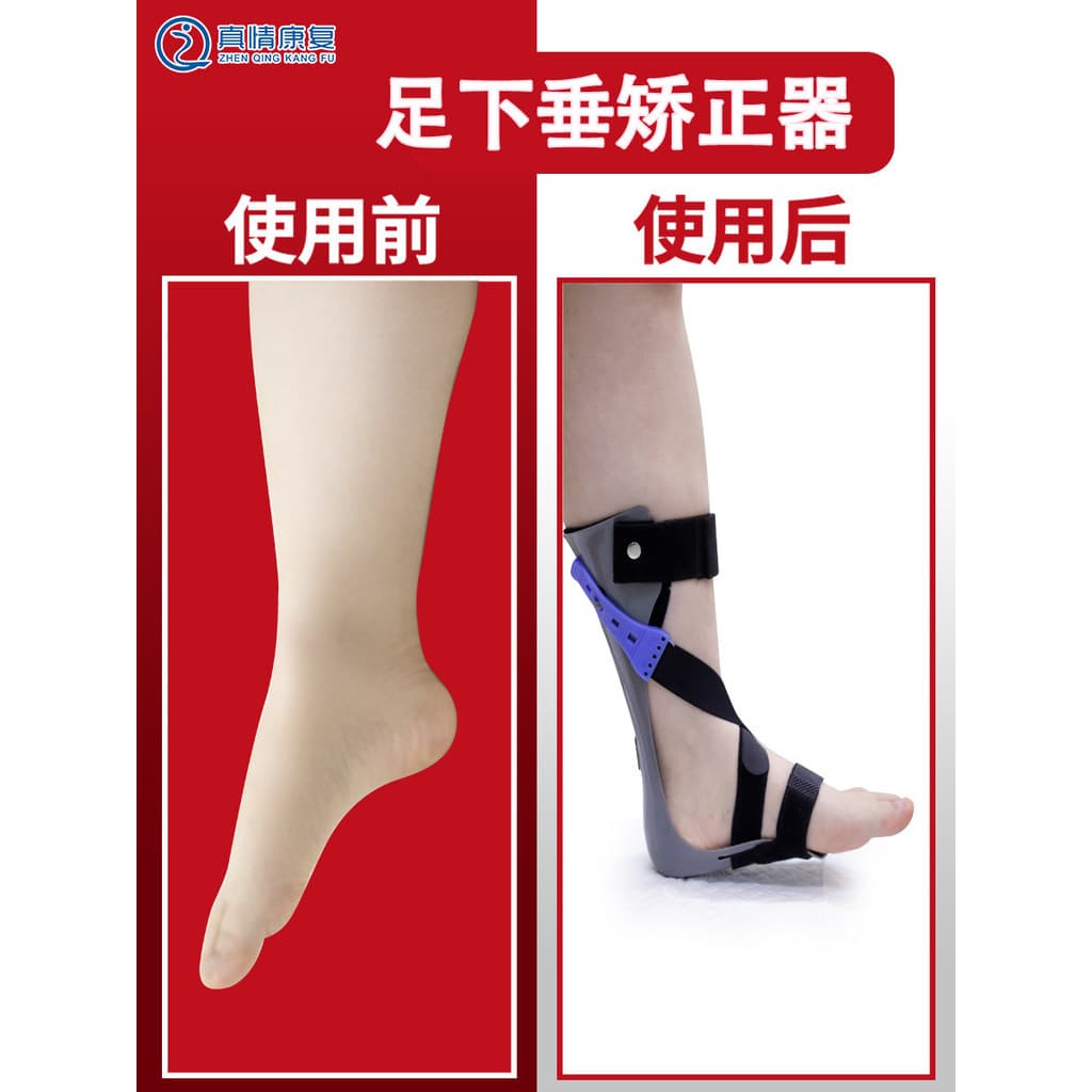 Pé gota pé valgus Shaper pé apoio tornozelo pé arrastar tornozelo pé postura Corrector pé valgus reabilitação T
