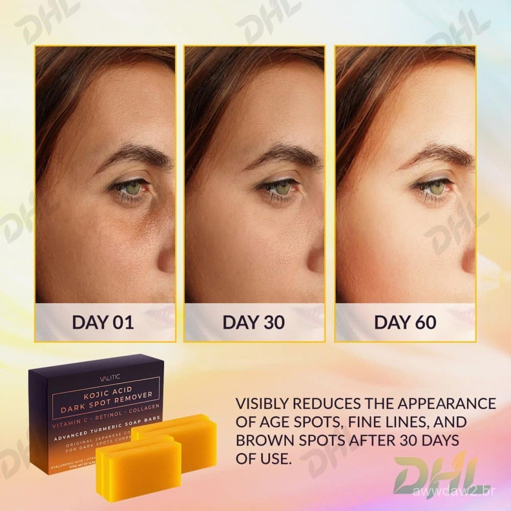 Sabonetes em Barra Removedores de Manchas Escuras VALITIC com Ácido Kójico, Vitamina C, Retinol, Colágeno, Cúrcuma - Com