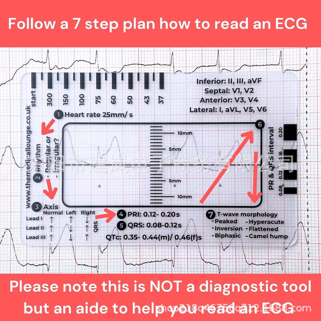 Ferramenta de medição de régua de plástico de régua de para explicação de ECG ECG ECG Régua de 7 etapas