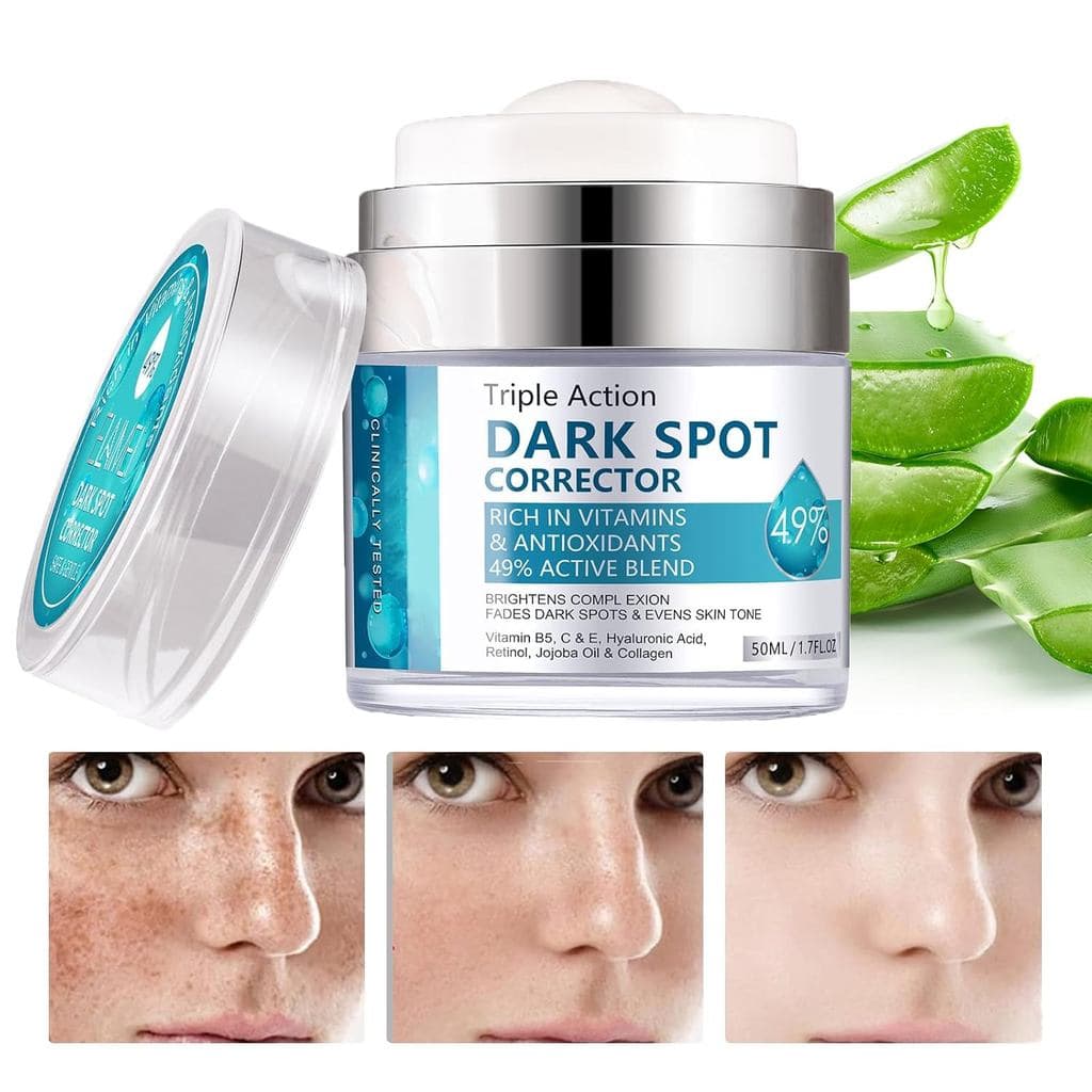 Creme para Remoção de Manchas Escuras Faciais, Creme para Remoção de Manchas Faciais, 50ml/1.7fl oz YKCC