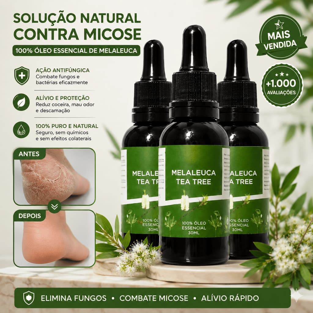 Óleo De Melaleuca Tea Tree 30ml 100% Puro Para Acne Micose Fungos Unhas Pele Couro Cabeludo