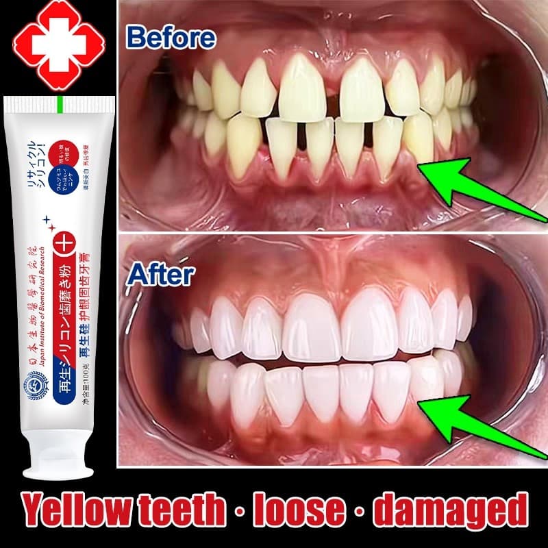 Novo Pasta De Dente Sólida Sem Flúor Do Japão 100g Reparadora remove Manchas De Placa Dentária Atrofia De Gengiva Repara