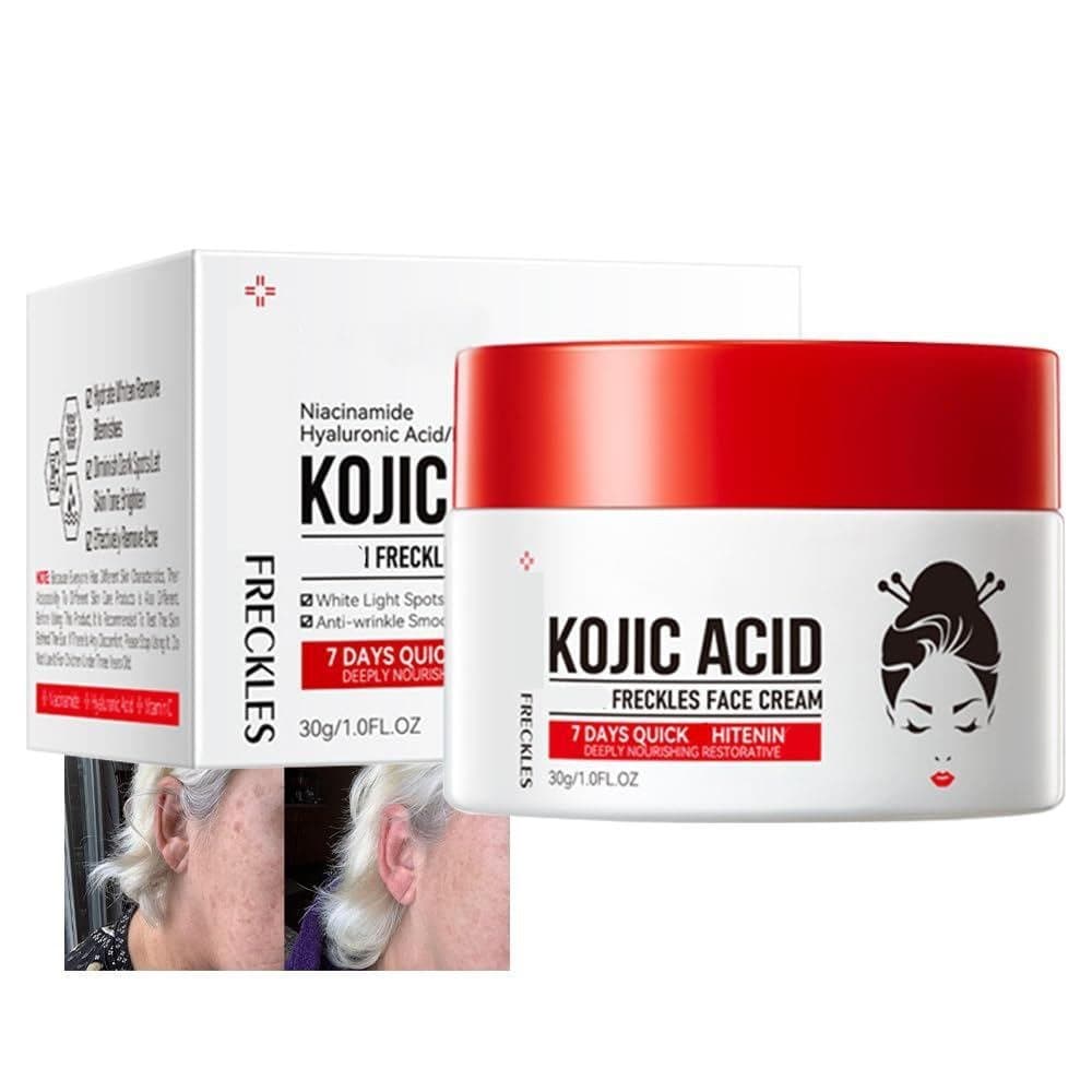 Creme de Ácido Kójico, Gel para Rosto e Corpo, Manchas Escuras, Melasma, Ingredientes Naturais, Efeito Hidratante e Calm