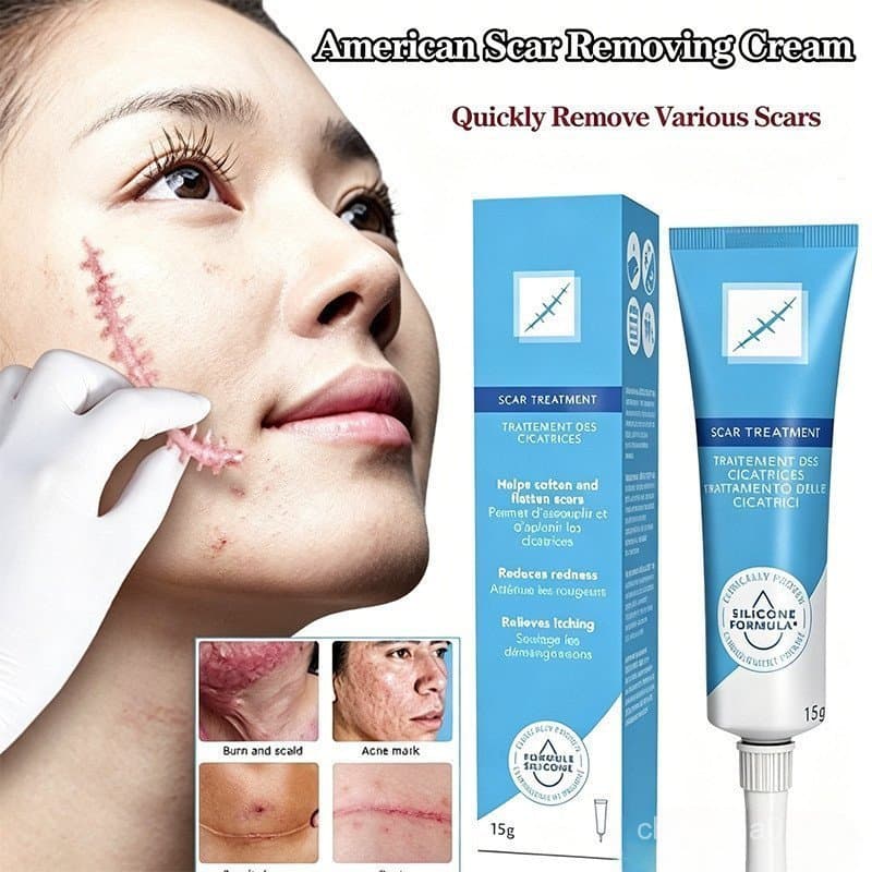 Creme para Remoção de Cicatrizes - Adequado para Restaurar a Pele, Suavizar e Eliminar Acne 15g QWYV JX2K