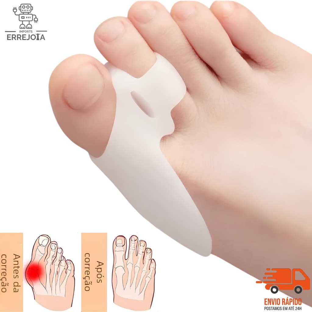 Protetor Corretor Joanete Silicone Gel Ortopédico Hallux Valgus Hipoalergênico Kit 1 a 3 Pares