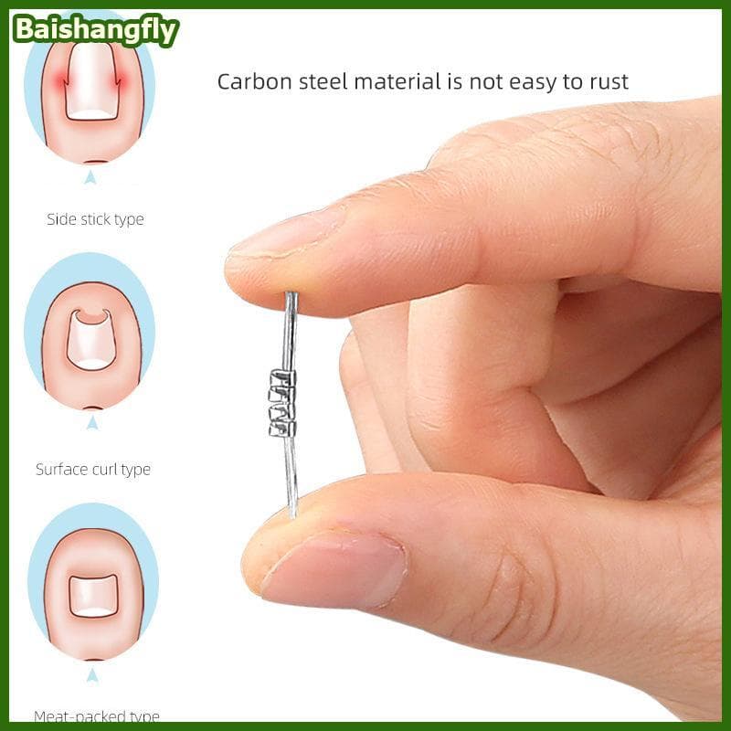 baishangfly Ferramentas Corretoras De Unhas Encravadas Pedicure Recuperar Incorporar Tratamento De Dedo Do Pé Profission