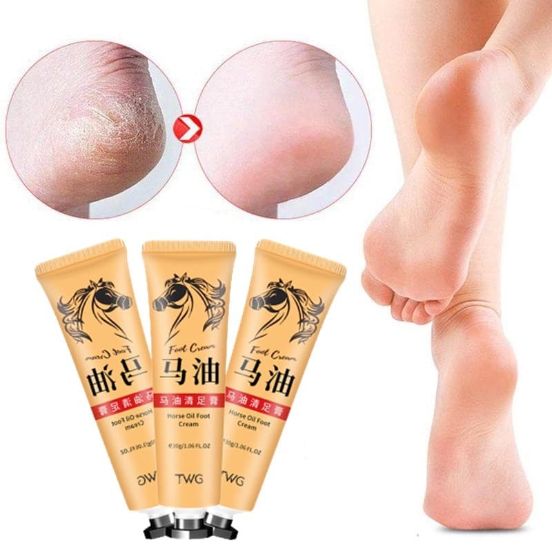 Creme Anti-Fratura Para Pés , Reparo De Remoção De Óleo De Cavalo , Cuidados Com Os Macios As Mãos , 30g