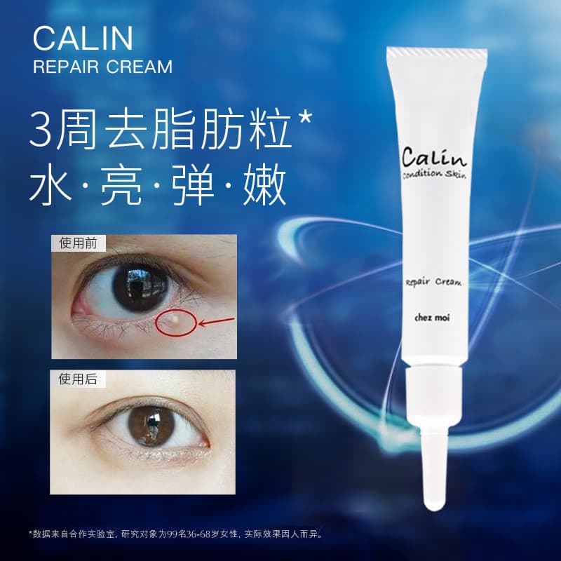 Japão japão Chezmoi novo estilo remover partículas de gordura creme olho pescoço remover partículas de gordura remover p