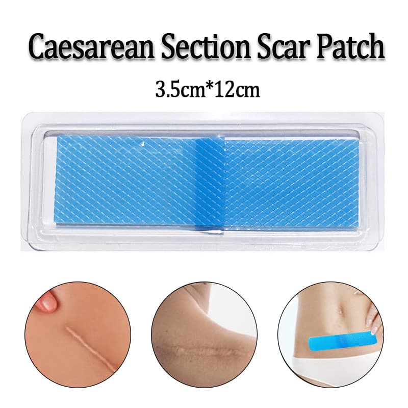 Remendo De Reparo De Seção De Cesariana De Gel De Silicone Para Lesões Cirúrgicas , Cicatriz Quelóide , Cuidados Com A P