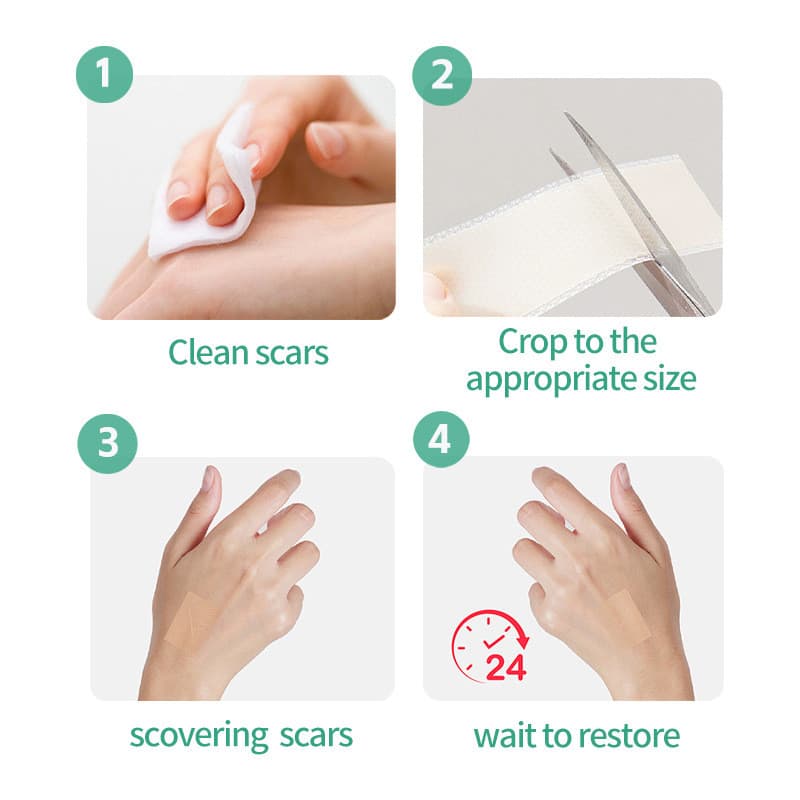 Adesivo de silicone à prova d'água para cicatrizes, adesivo para hiperplasia de cicatrizes, corretivo de gel de silicone