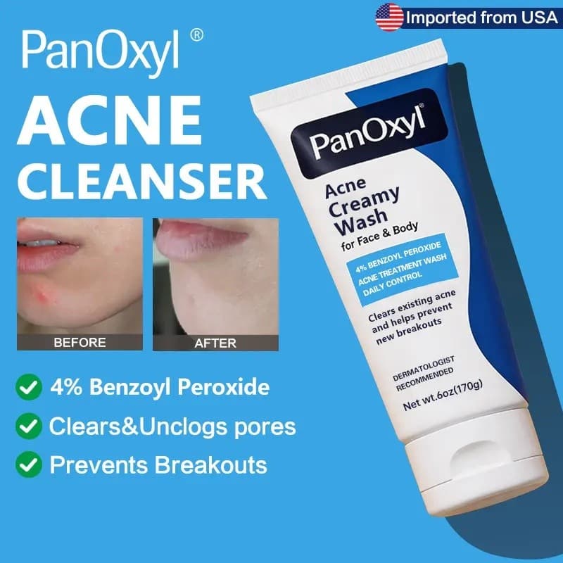 Limpador Facial para Tratamento de Acne Panouil 4% Peróxido de Benzoíla (BP), Limpador Diário para Tratamento de Acne no