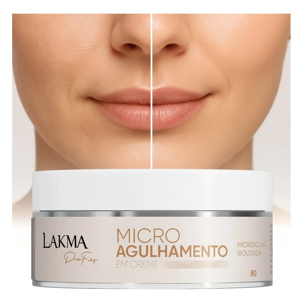 Microagulhamento Em Creme Lakma 8g Com Espiculite Renovação Sem Dor Todo Tipo De Pele Dia/noite