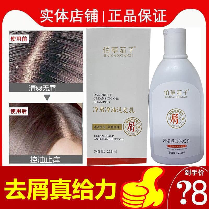 Herborist caspa óleo de limpeza shampoo selênio dissulfide shampoo anti-caspa anti-coceira shampoo controle de óleo fofo
