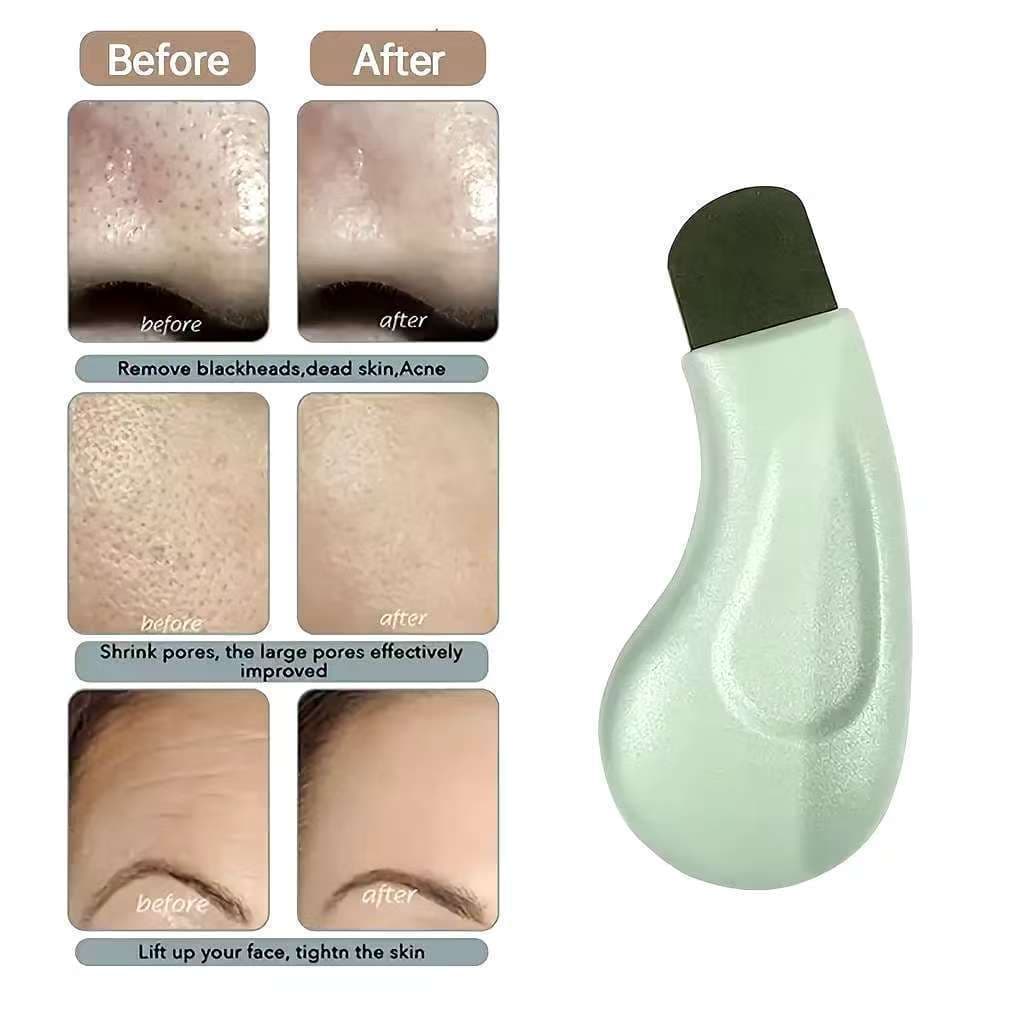 1/2 Profissional Nariz Limpeza Profunda Cravo Espinha Ferramenta De Remoção Rosto Esfoliante Espátula Poros Mais Limpo