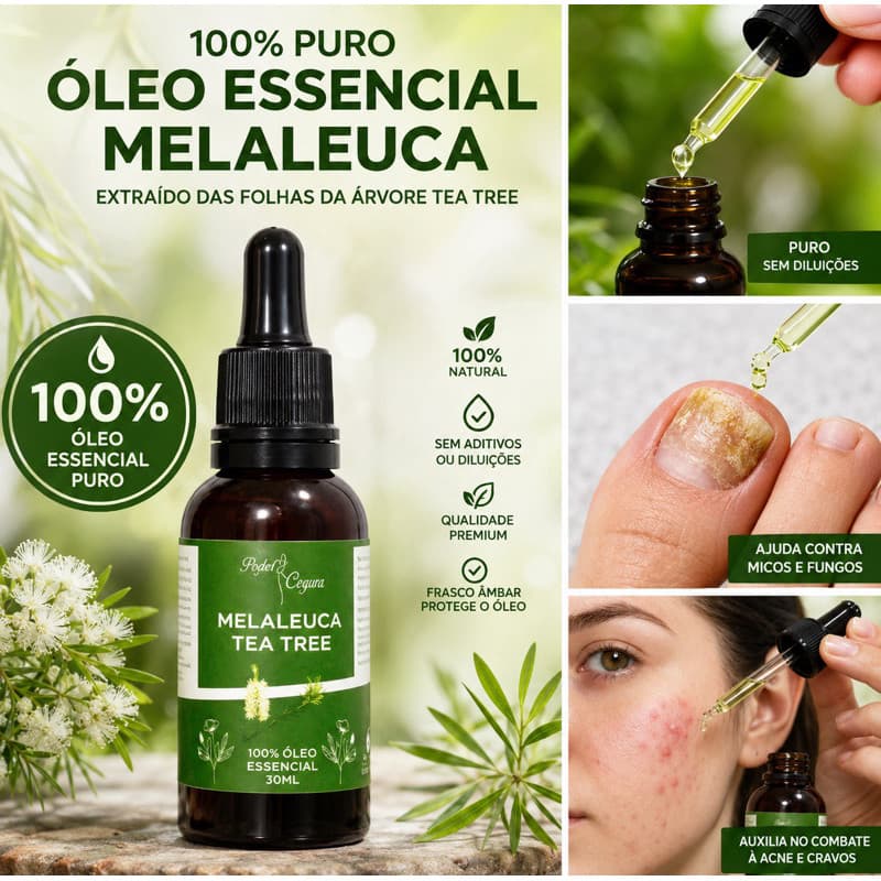 Óleo Essencial De Melaleuca Tea Tree Conta Gotas 100% Puro 30ml Contra Micose Acne