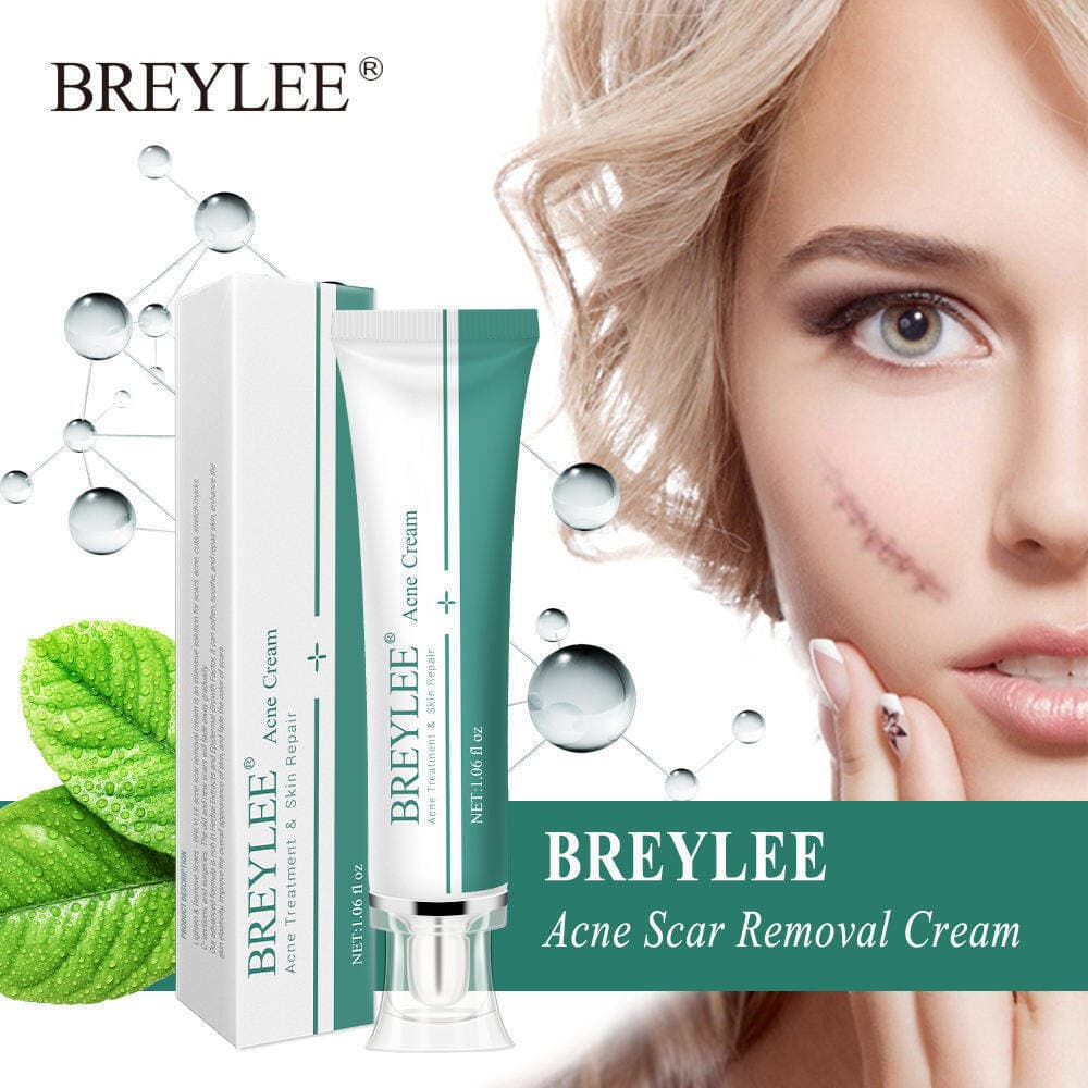 BREYLEE Creme Para Remoção De Cicatrizes De Acne , Reparação De Estrias , Marcas De Espinhas , Cuidados Com A Pele 30g