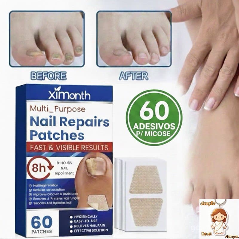 Adesivos para Fungos nas Unhas, 60/120 Peças, Adesivo para Reparação de Unhas dos Pés, Adesivo Corretor de Fungos Cinza