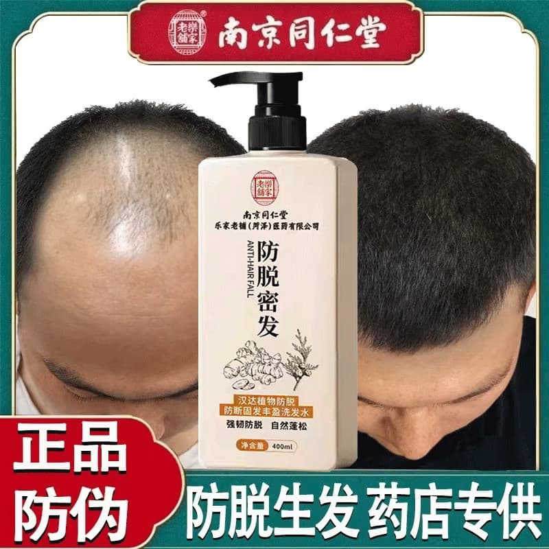 Nanjing Tongrentang Anti-Queda de Cabelo Anti-Queda de Cabelo Shampoo Linha Fina Careca Aumenta o Cabelo Cabelo Denso An