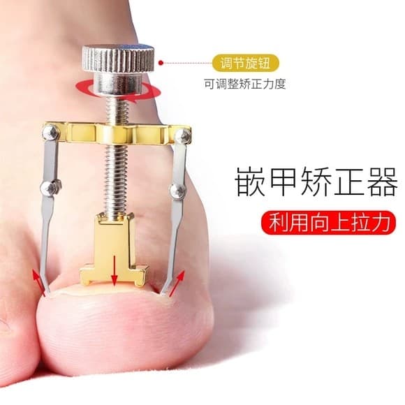 Corretor de unhas tesoura de unhas encravadas Pedicure ferramenta útil alicate Olecranon correção de unhas ferramenta en
