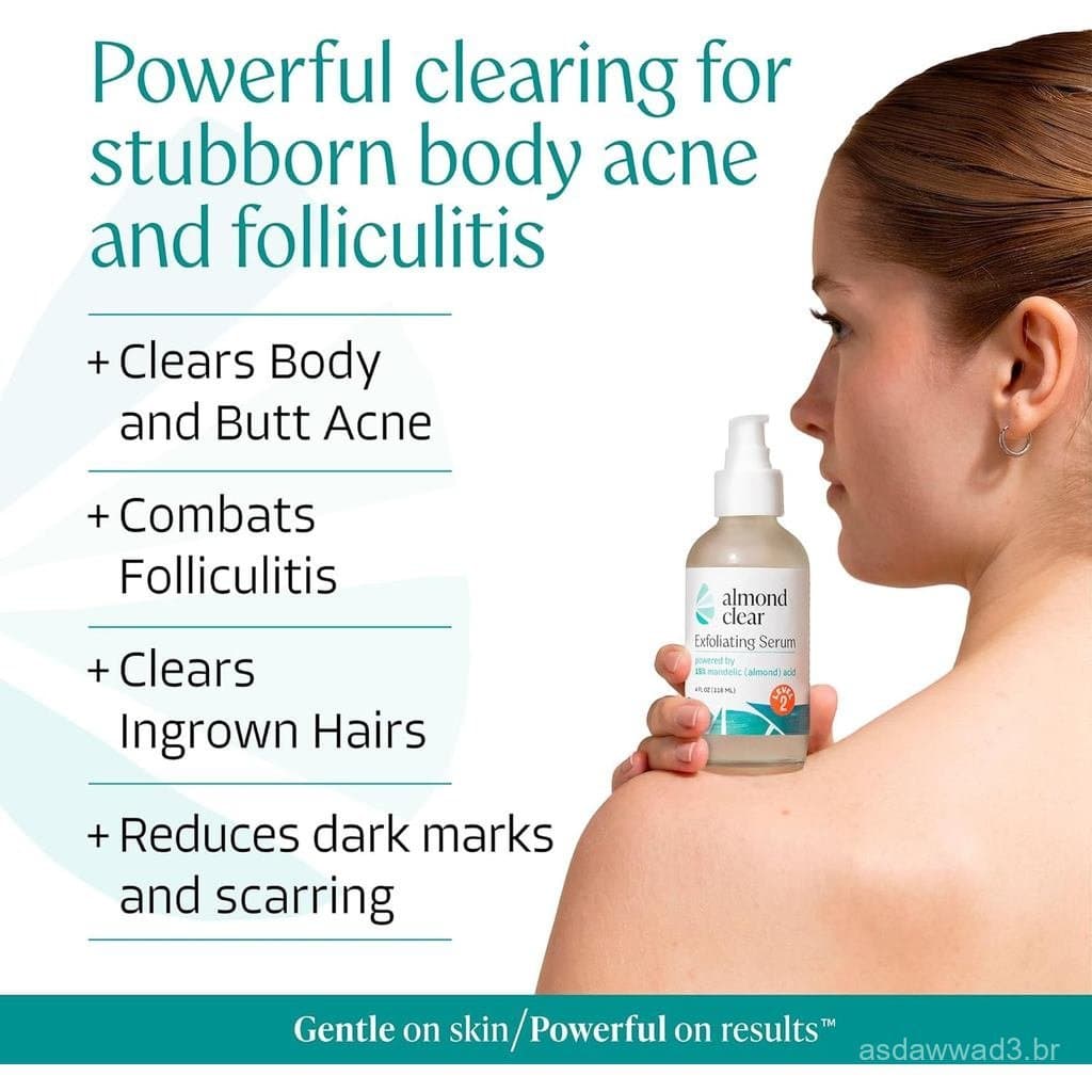 AlmondClearMandelicAcidLevel2Serum – Tratamento de Alta Potência para Acne Corporal, Foliculite e Pelos Encravados – Rem