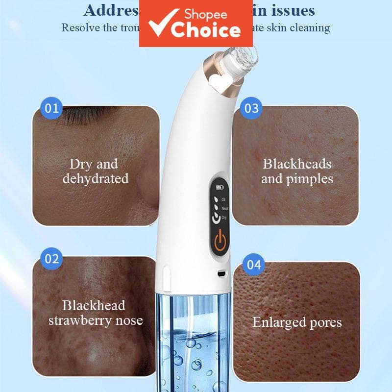 Removedor de cravos de mini bolhas para uso doméstico, dispositivo de aperto de poros, limpador facial, recarregável