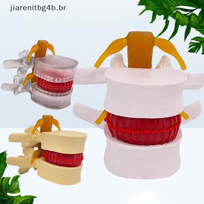 JIARN Profissão Modelo Lombar Anatomia Humana Esqueleto Coluna Disco Hérnia De Ensino Demonstração Instrumento Médico .