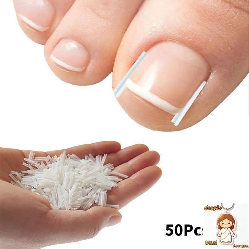 50PCS Ferramenta de Correção de Unha Encravada Clipe Adesivo Elástico para Tratamento de Cuidados com os Pés 6511