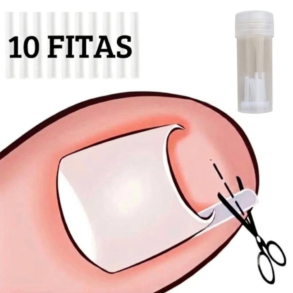 Fita Ortese Desencravadora de unha 1 frasco com 10 Tiras