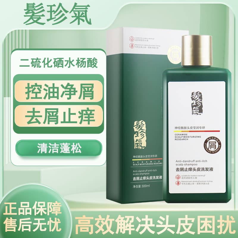 Cabelo Zhenqi shampoo anticaspa anti-coceira controle de óleo suave fragrância shampoo oficial genuíno couro cabeludo sh