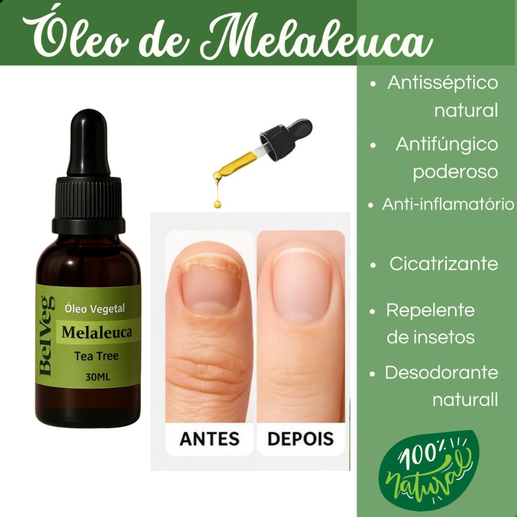 Óleo Vegetal Melaleuca Tea Tree 100% Puro 30ml  Para Unha Pele Cabelo..